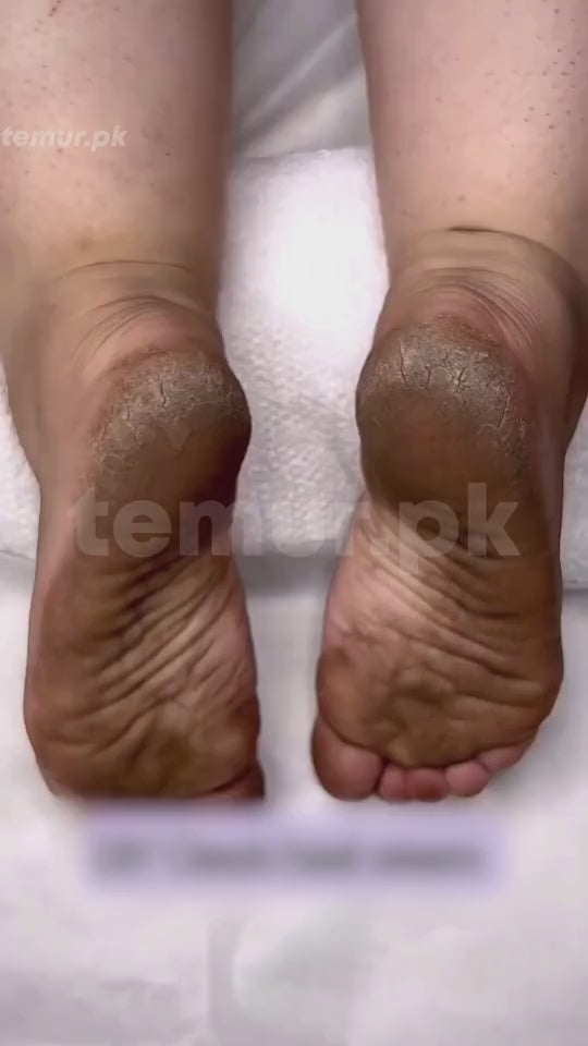 Electric Foot File Grinder