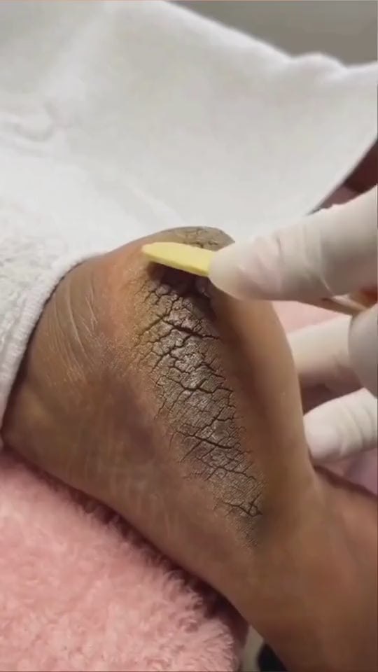 Electric Foot File Grinder